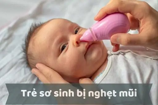 Chữa Nghẹt Mũi Cho Trẻ 6 Tháng Tuổi