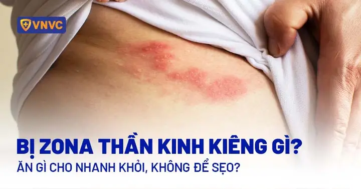 Có Kinh Thì Không Nên Ăn Gì