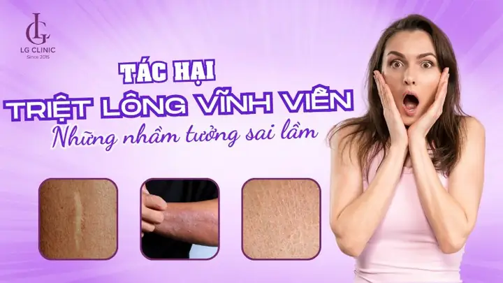 Có Mẹ Nào Triệt Lông Vĩnh Viễn Chưa