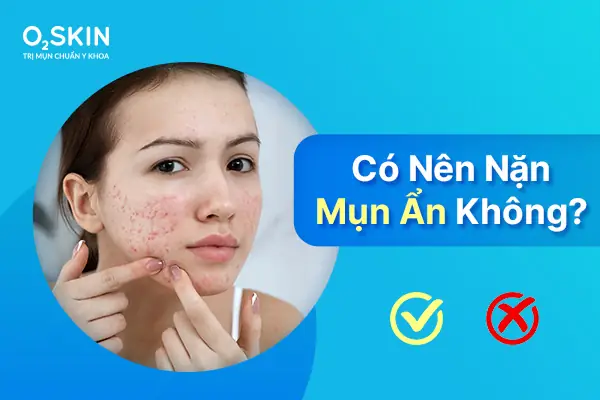 Có Nên Đẩy Mụn An Không