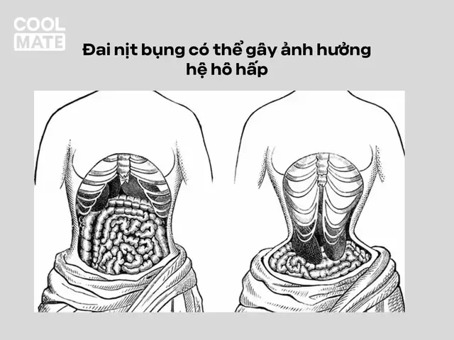 Có Nên Đeo Nịt Bụng Khi Tập Gym