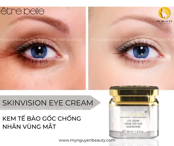 Có Nên Dùng Kem Dưỡng Mắt