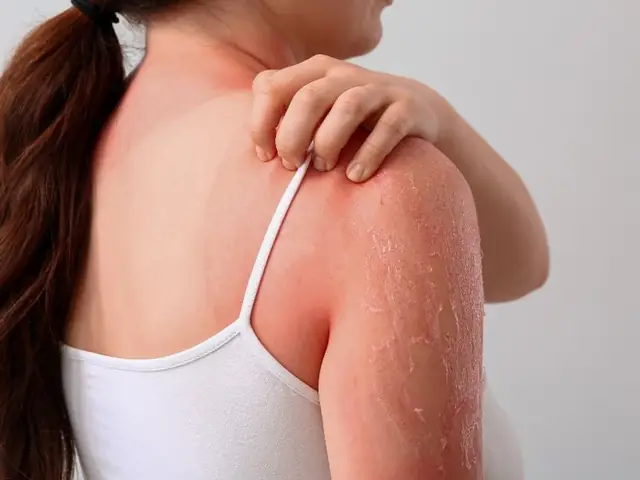 Có Nên Dùng Sữa Tắm Hàng Ngày Không Có Nên Dùng Sữa Tắm Hàng Ngày Không