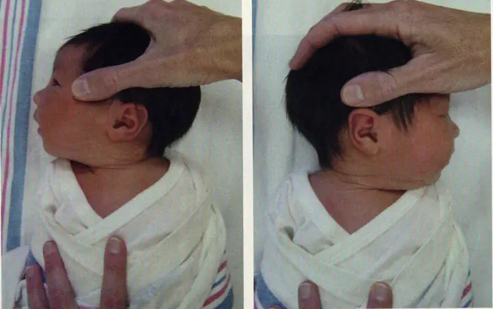 Có Nên Gối Đầu Cho Trẻ Sơ Sinh