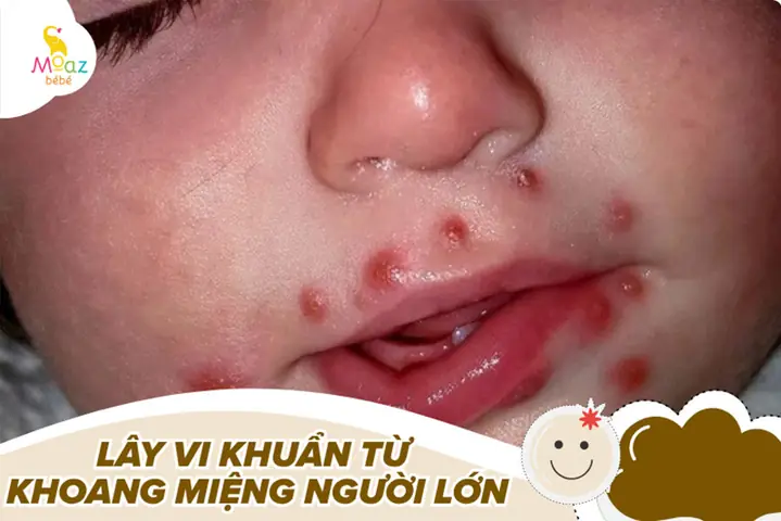 Có Nên Hôn Trẻ Sơ Sinh Không