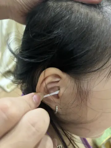 Có Nên Lấy Ráy Tai Cho Trẻ Không