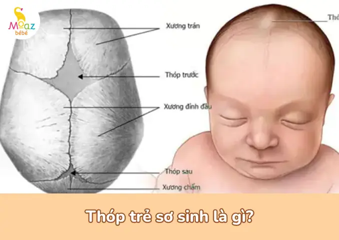 Có Nên Thoa Dầu Lên Thóp Trẻ Sơ Sinh