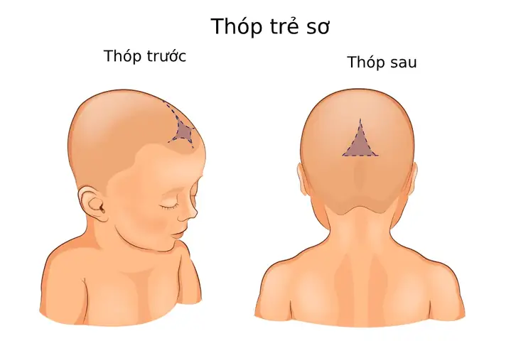 Có Nên Thoa Dầu Lên Thóp Trẻ Sơ Sinh