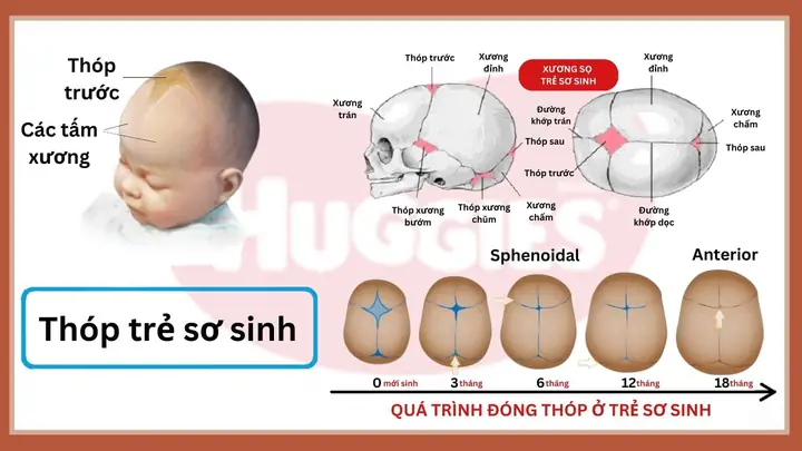 Có Nên Thoa Dầu Lên Thóp Trẻ Sơ Sinh