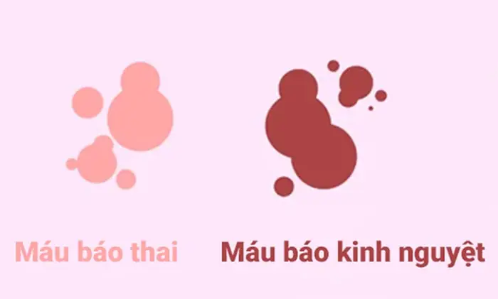 Có Thai 3 Tháng Đầu Ra Dịch Màu Nâu