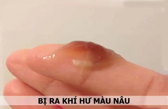 Có Thai 3 Tháng Đầu Ra Dịch Màu Nâu