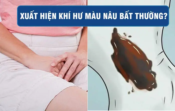 Có Thai 3 Tháng Đầu Ra Dịch Màu Nâu