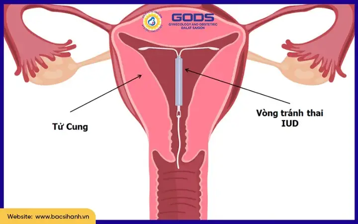 Co Thai An Luu Tot Khong