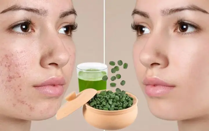 Công Dụng Của Tảo Xoắn Đắp Mặt Công Dụng Của Tảo Xoắn Đắp Mặt
