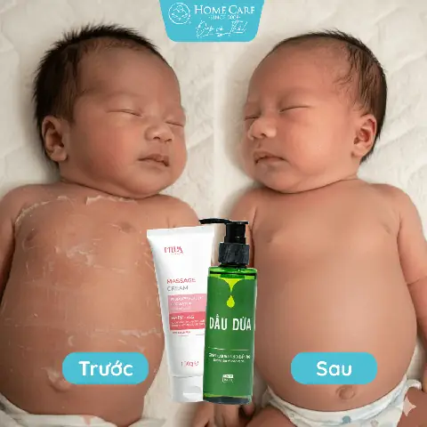 Công Dụng Dầu Massage Cho Bé