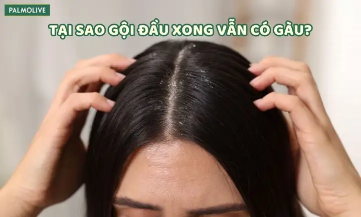 Cứ Gội Đầu Là Bị Rụng Tóc