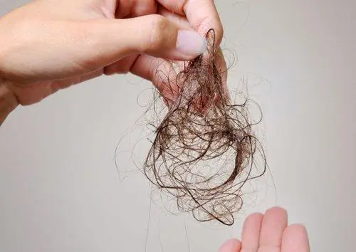 Cứ Gội Đầu Là Bị Rụng Tóc