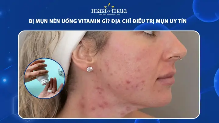 Da Bị Mụn Nên Uống Vitamin Gì