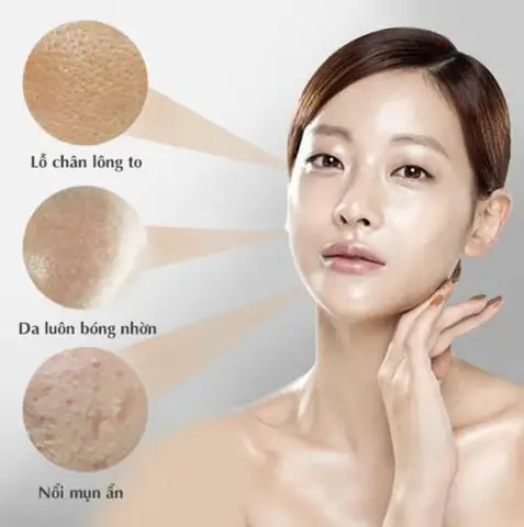 Da Dầu Nên Sử Dụng Kem Chống Nắng Nào