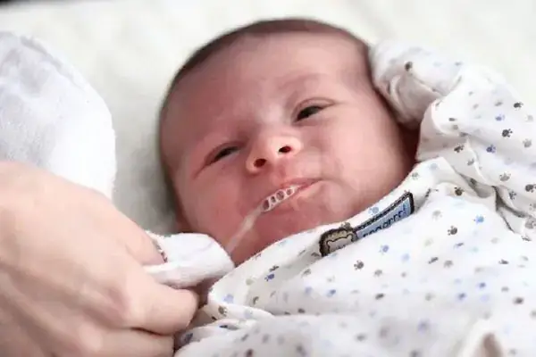 Dạ Dày Của Trẻ 2 Tháng Tuổi