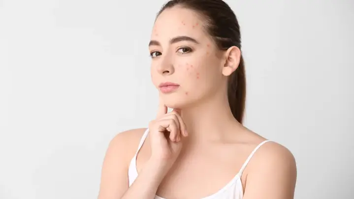 Da Hỗn Hợp Đắp Mặt Nạ Gì