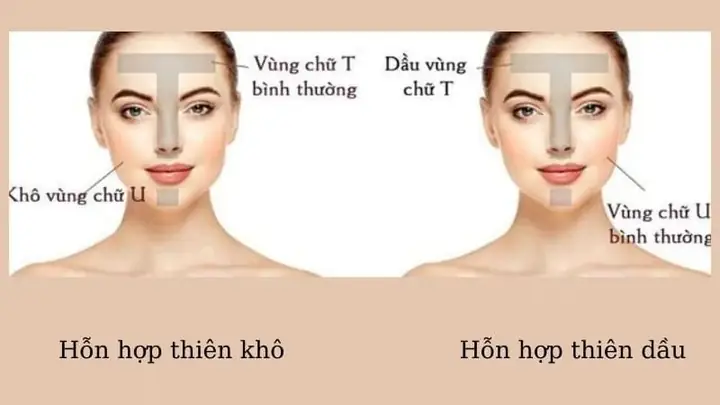Da Hỗn Hợp Thiên Dầu Nên Dụng Serum Gì
