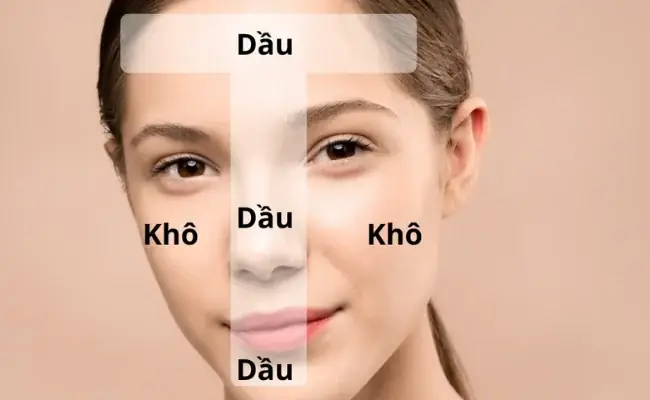 Da Hỗn Hợp Thiên Dầu Nên Dụng Serum Gì
