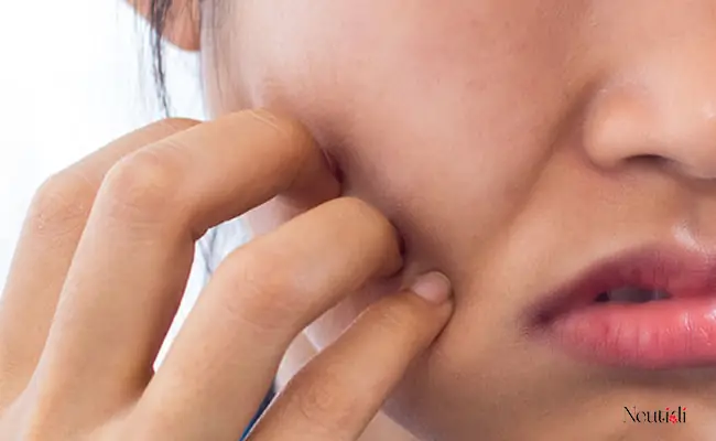 Da Mặt Bị Rát Khi Rửa Mặt