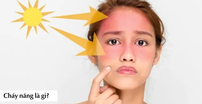 Da Mặt Bị Sạm Đen Phải Làm Sao