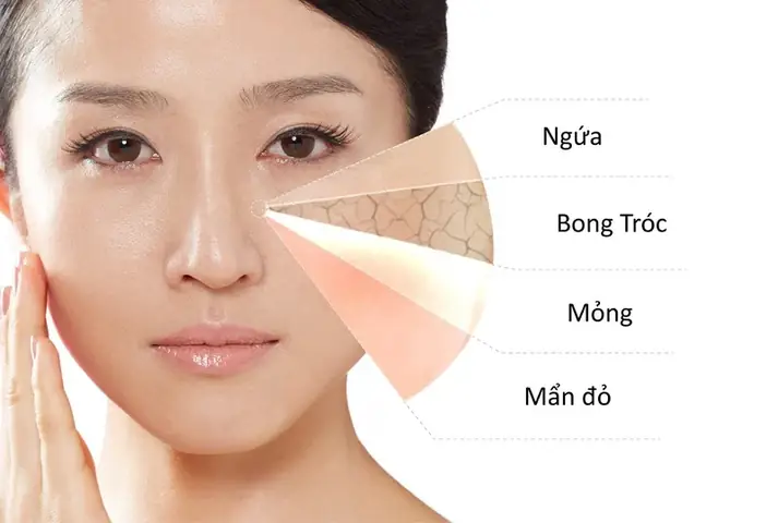 Da Mặt Khô Nên Dùng Kem Gì