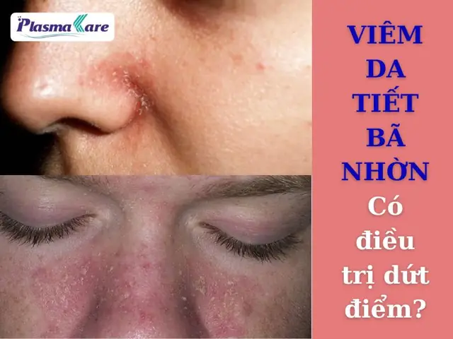Da Mặt Nhờn Nên Dùng Kem Gì