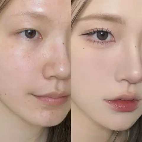 Da Mặt Nhờn Nên Dùng Kem Gì