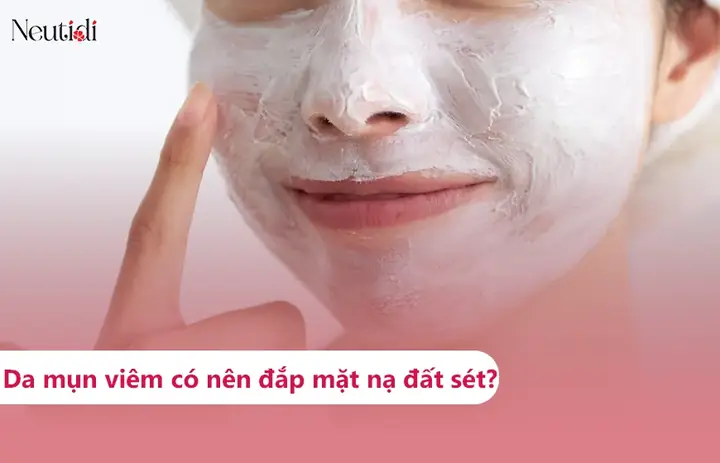 Da Mụn Có Nên Dùng Mặt Nạ Đất Sét