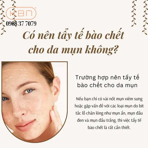 Da Mụn Có Nên Tẩy Tế Bào Chết Không