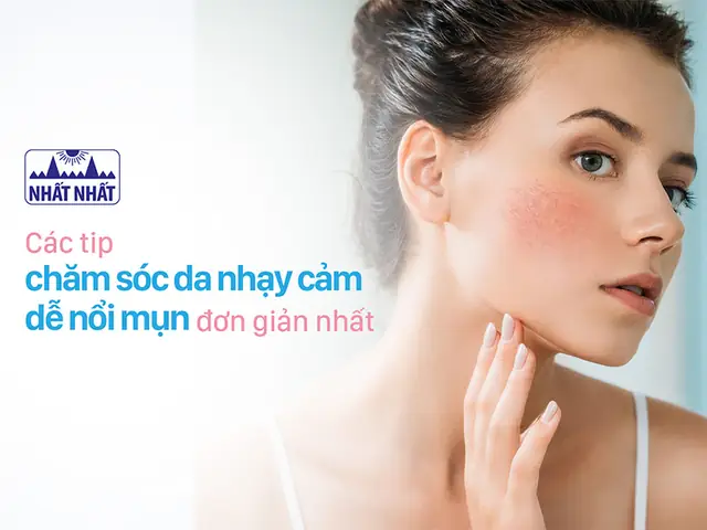 Da Nhạy Cảm Dễ Nổi Mụn