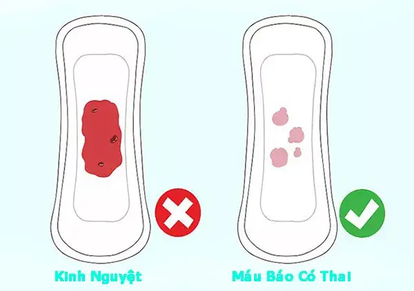 Đau Đầu Có Phải Dấu Hiệu Mang Thai