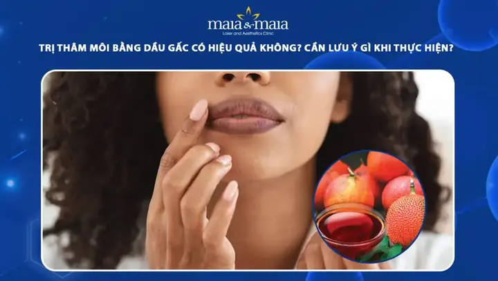 Dầu Gấc Trị Mụn Tốt Không