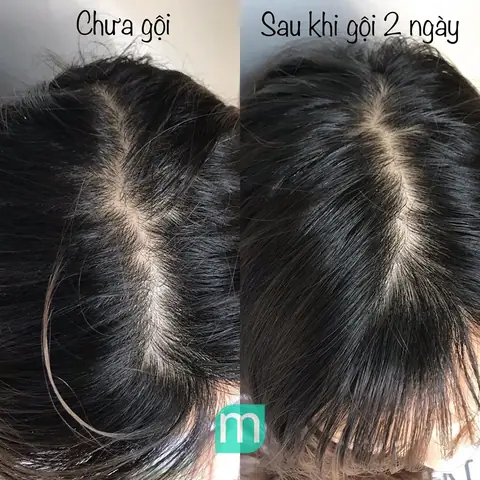 Dầu Gội Beauty And Planet Review