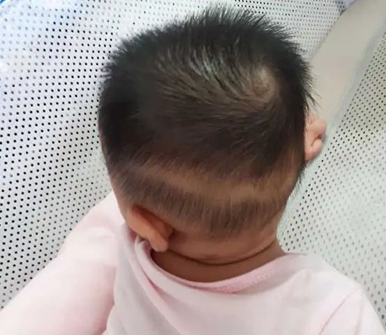 Dấu Hiệu Của Trẻ Thiếu Canxi