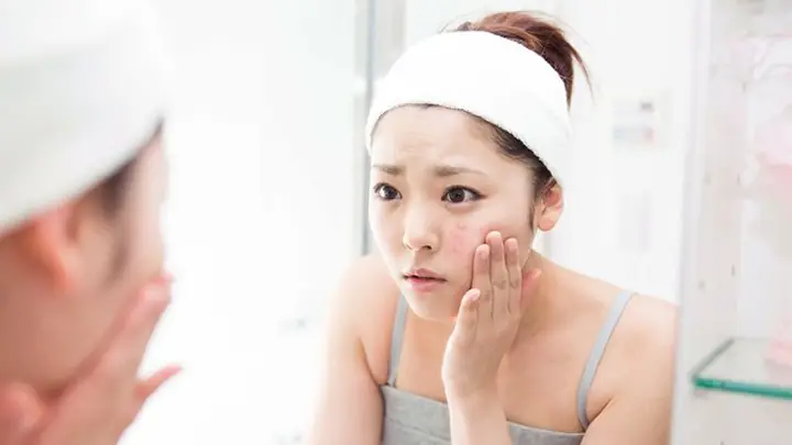 Dấu Hiệu Da Không Hợp Mỹ Phẩm