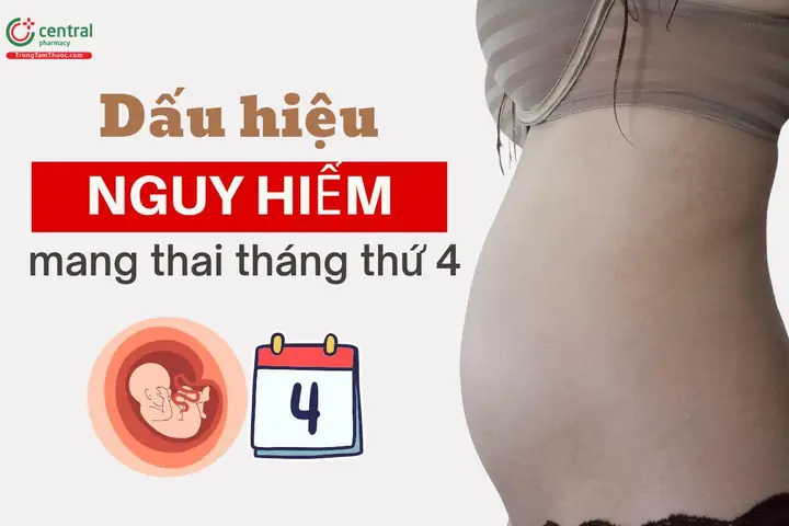 Dấu Hiệu Đau Lưng Khi Mang Thai Tháng Đầu