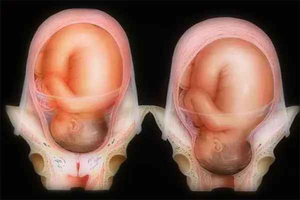 Dấu Hiệu Nhận Biết Cổ Tử Cung Mở