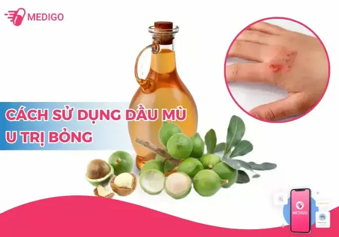 Dầu Mù U Trị Bỏng Bô