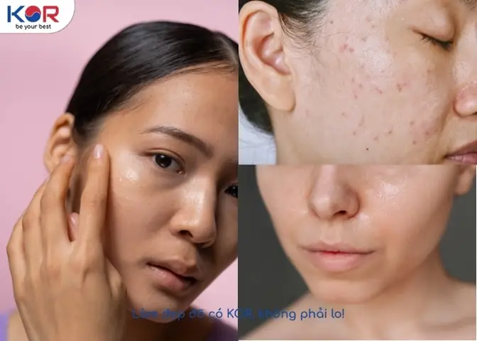 Dầu Tẩy Trang Hàn Quốc Nào Tốt