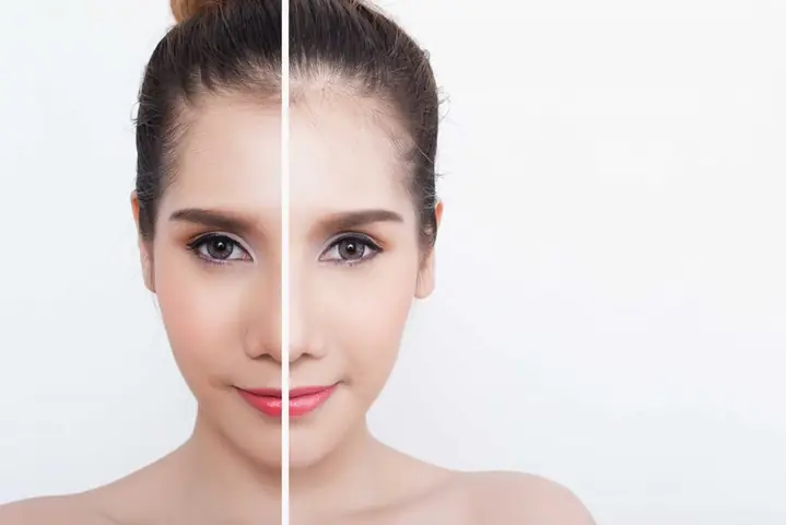 Decumar Có Làm Trắng Da Không