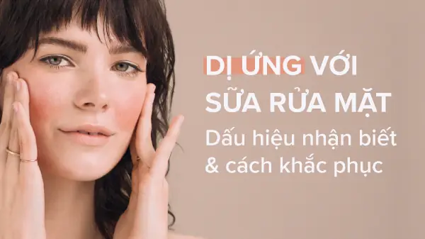 Dị Ứng Sữa Rửa Mặt Phải Làm Sao