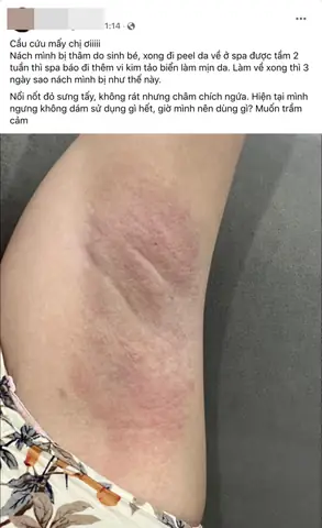 Diễn Đàn Làm Đẹp Sau Sinh