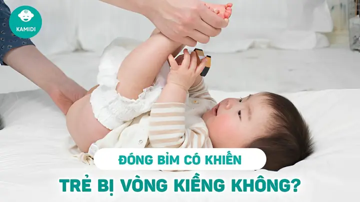 Đóng Bỉm Cho Trẻ Sơ Sinh Có Bị Vòng Kiềng Đóng Bỉm Cho Trẻ Sơ Sinh Có Bị Vòng Kiềng