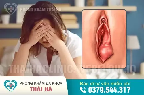 Dùng Bao Cao Su Bị Rát