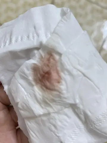 Dùng Bao Cao Su Bị Rát